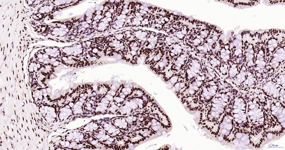 组蛋白H3(核内参)重组兔单抗