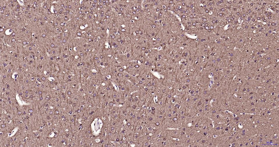 微管蛋白β tubulin/Tubulin β(内参)重组兔单抗