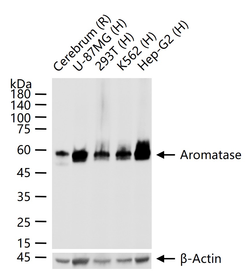 芳香化酶/细胞色素P450/雌激素合成酶重组兔单抗