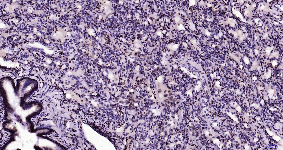 组蛋白H3(核内参)重组兔单抗