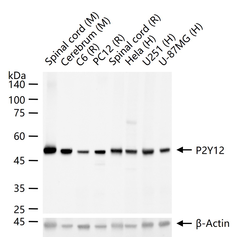 G蛋白偶联嘌呤受体p2y12重组兔单抗