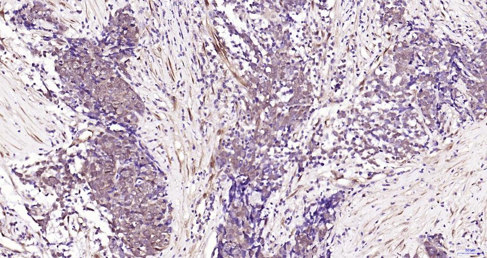 磷酸化丝裂原活化蛋白激酶1/2抗体