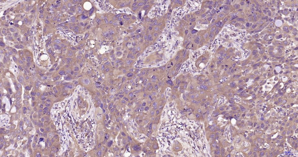 髓样分化蛋白重组兔单抗