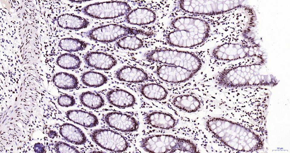 组蛋白H3(核内参)重组兔单抗