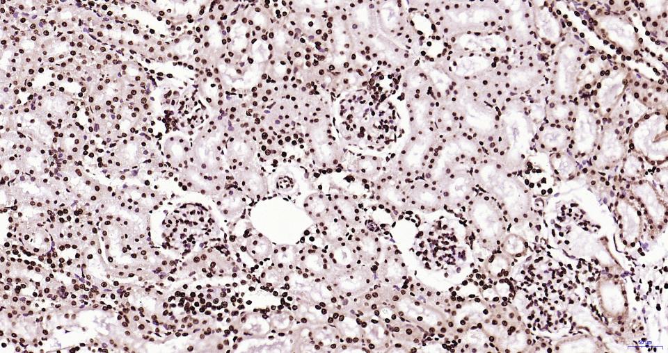 组蛋白H3(核内参)重组兔单抗