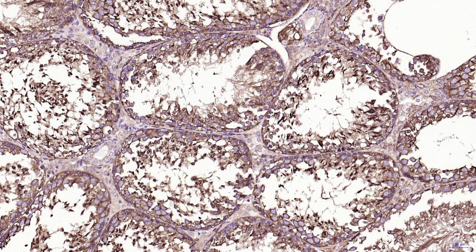 微管蛋白β tubulin/Tubulin β(内参)重组兔单抗