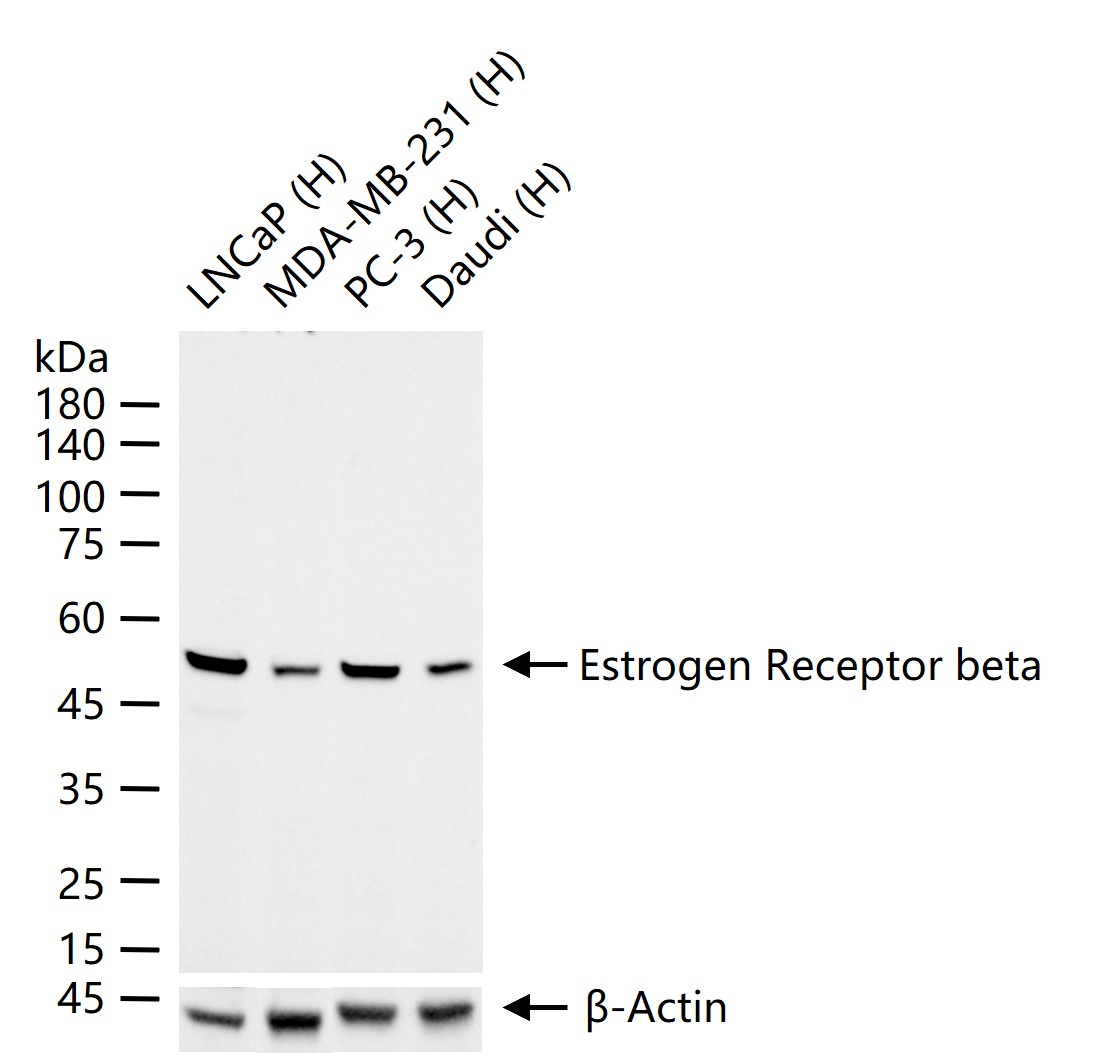雌激素受体β重组兔单抗