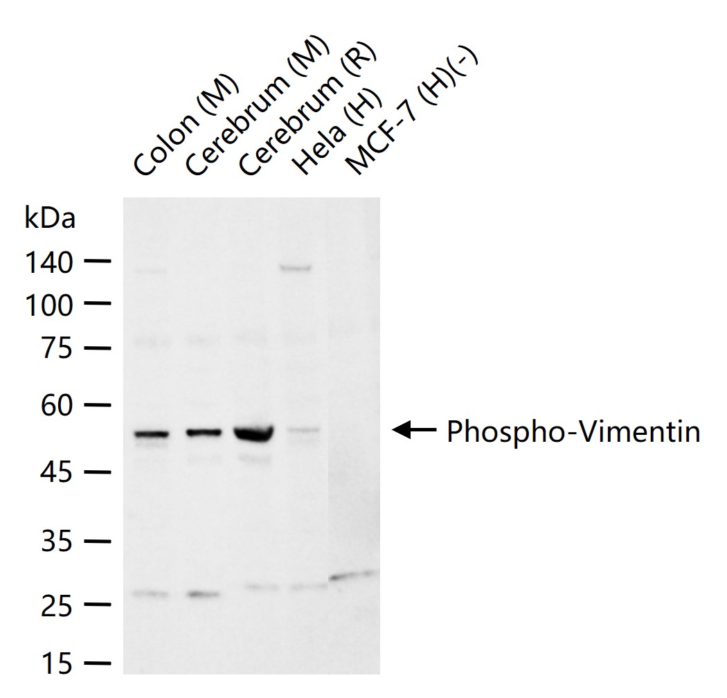 phospho-Vimentin (Ser56) Rabbit pAb (一抗) | Bioss
