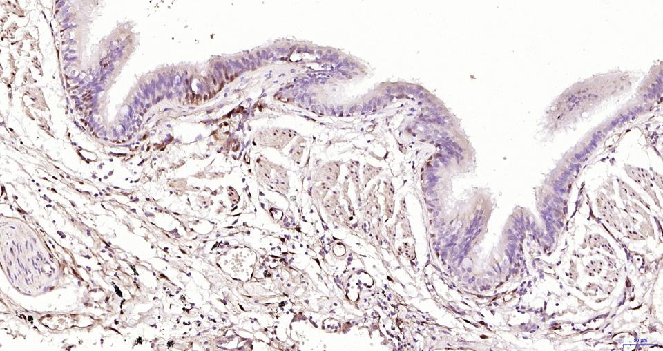 磷酸化丝裂原活化蛋白激酶1/2抗体