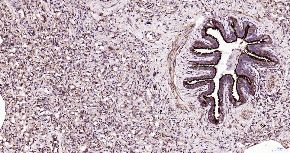 微管蛋白β tubulin/Tubulin β(内参)重组兔单抗