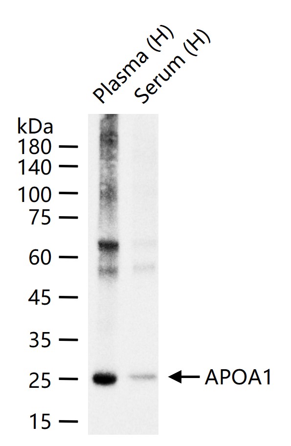 载脂蛋白A1重组兔单抗