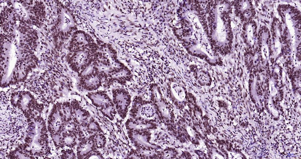 组蛋白H3(核内参)重组兔单抗