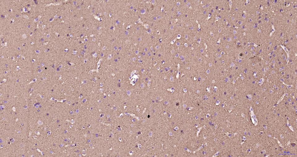 微管蛋白β tubulin/Tubulin β(内参)重组兔单抗