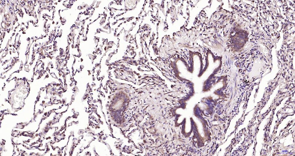 髓样分化蛋白重组兔单抗