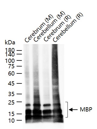 髓鞘碱性蛋白/磷脂碱性蛋白重组兔单抗