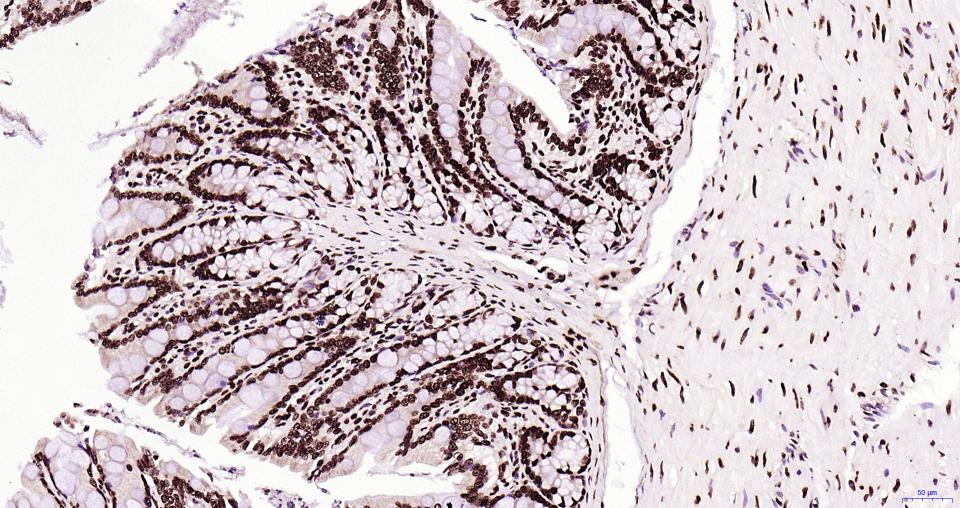 组蛋白H3(核内参)重组兔单抗