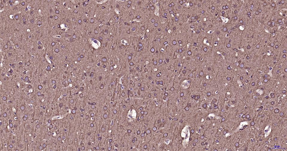 微管蛋白β tubulin/Tubulin β(内参)重组兔单抗
