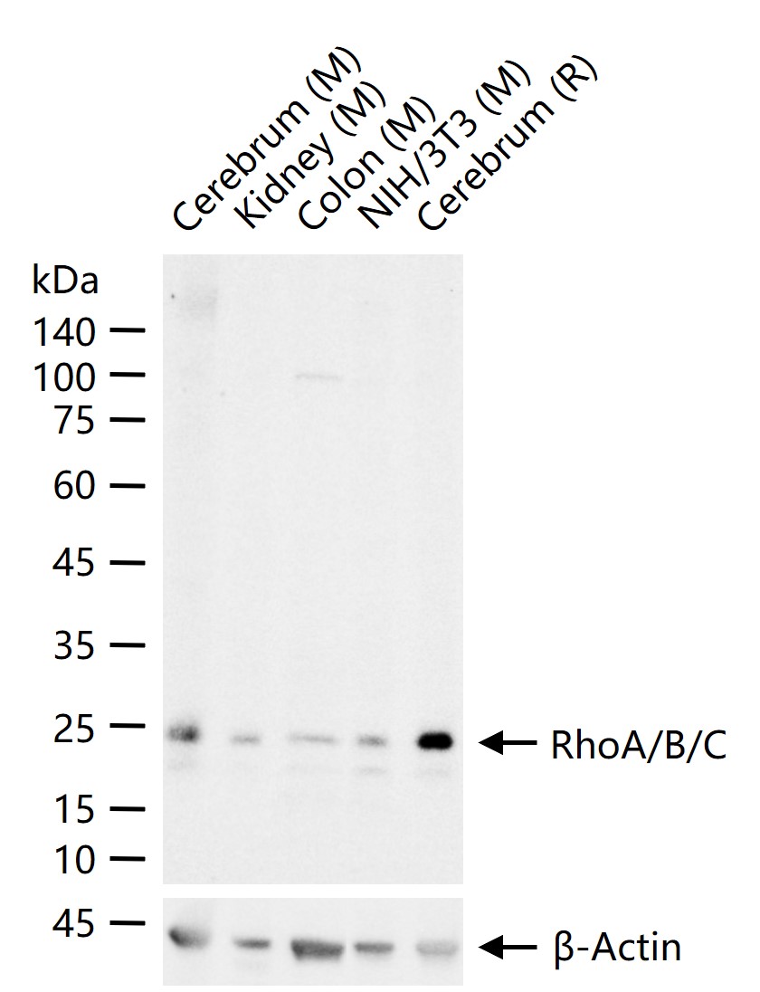 RhoA/B/C重组兔单抗