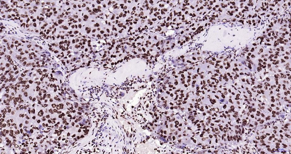 组蛋白H3(核内参)重组兔单抗