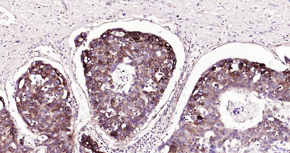 微管蛋白β tubulin/Tubulin β(内参)重组兔单抗