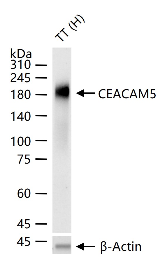 癌胚抗原重组兔单抗