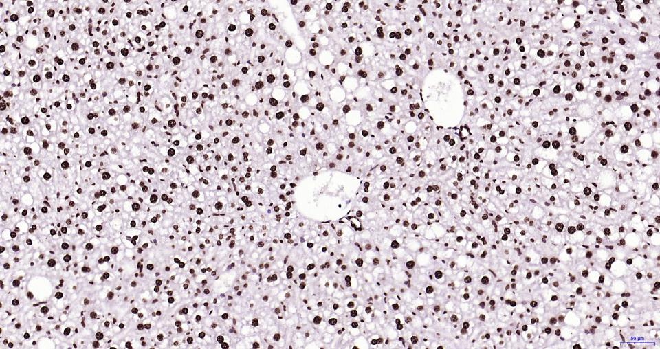 组蛋白H3(核内参)重组兔单抗