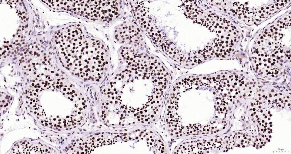 组蛋白H3(核内参)重组兔单抗
