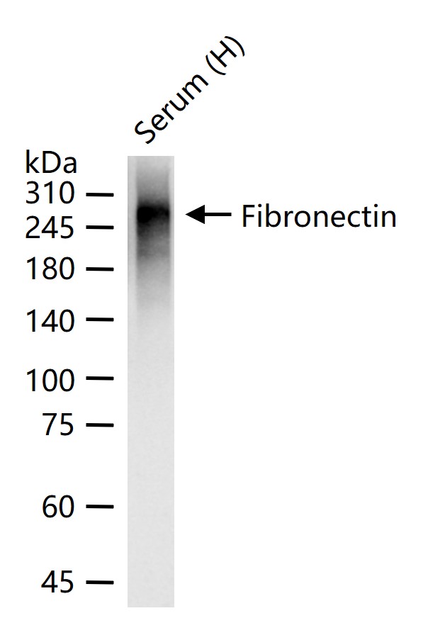 纤维连接蛋白重组兔单抗