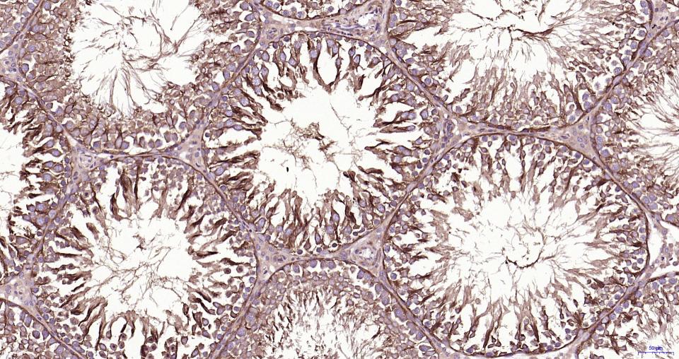 微管蛋白β tubulin/Tubulin β(内参)重组兔单抗