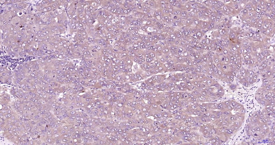 葡萄糖调节蛋白78重组兔单抗