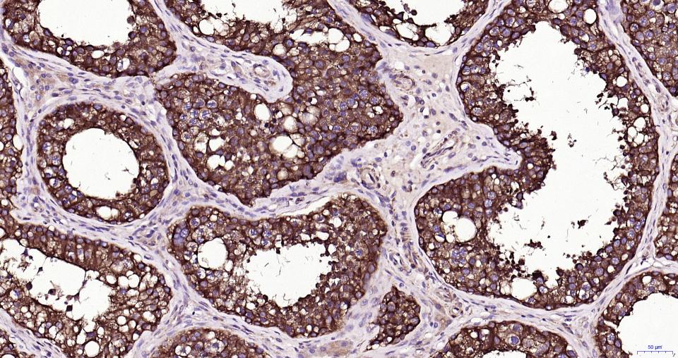 微管蛋白β tubulin/Tubulin β(内参)重组兔单抗
