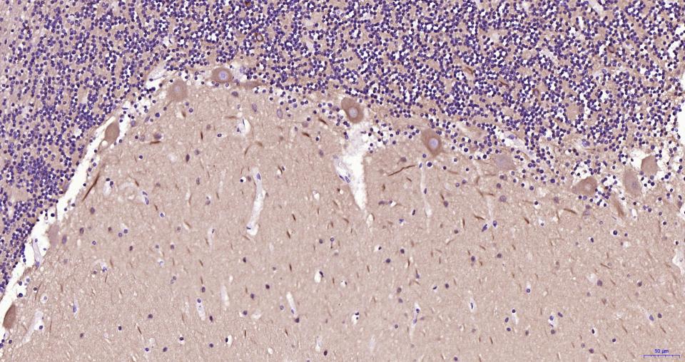 微管蛋白β tubulin/Tubulin β(内参)重组兔单抗