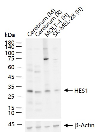 转录因子HES-1重组兔单抗-bsm-52568R