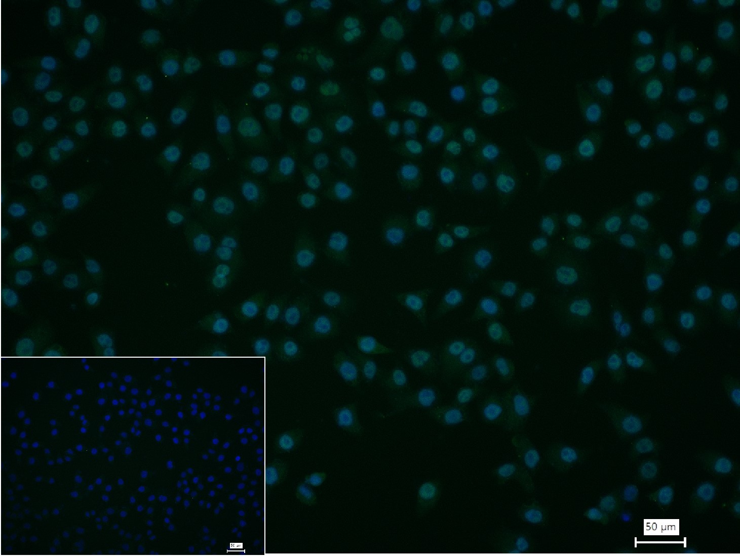 磷酸化RNA聚合酶II CTD重组兔单抗