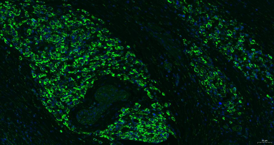 细胞表面趋化因子受体4抗体-bs-20317R