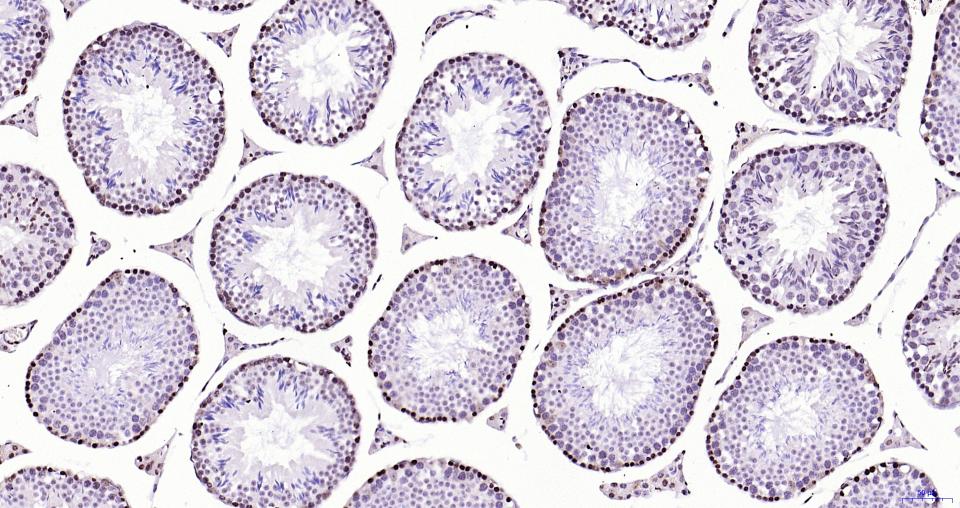 乙酰化组蛋白H3.1(Lys28)重组兔单抗