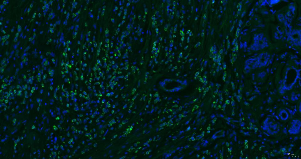 细胞表面趋化因子受体4抗体-bs-20317R