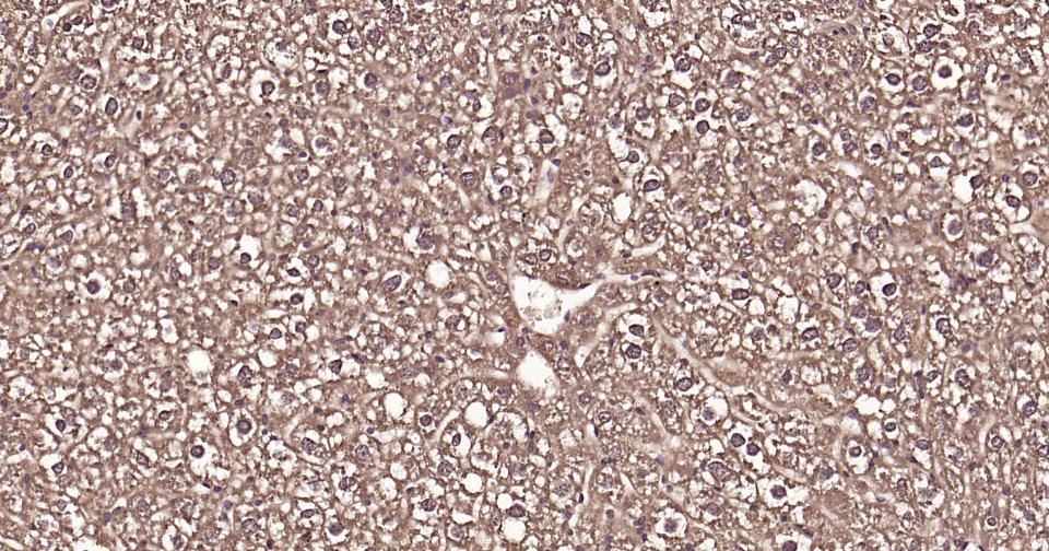 泛素蛋白（K63-linkage）重组兔单抗