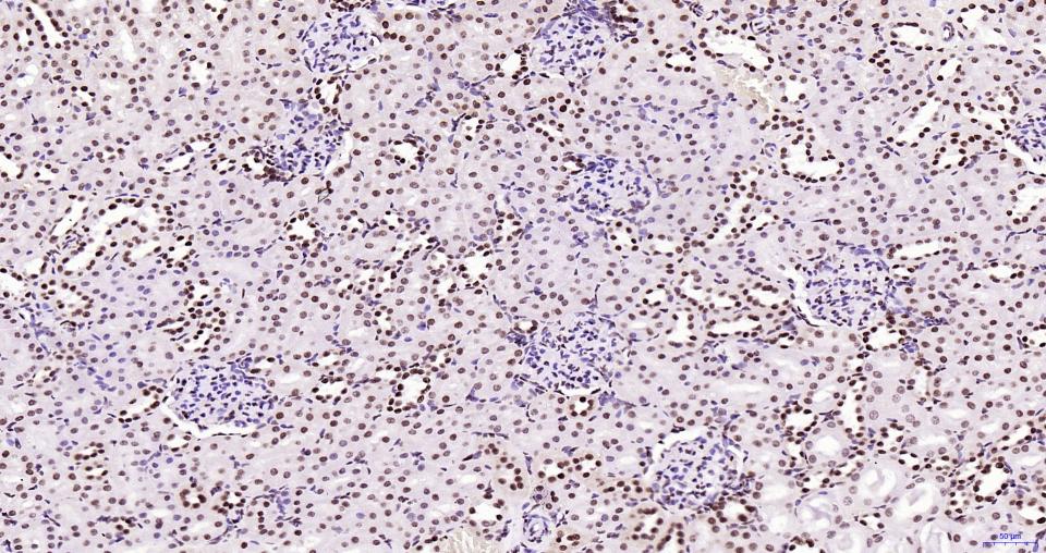 乙酰化组蛋白H3.1(Lys28)重组兔单抗