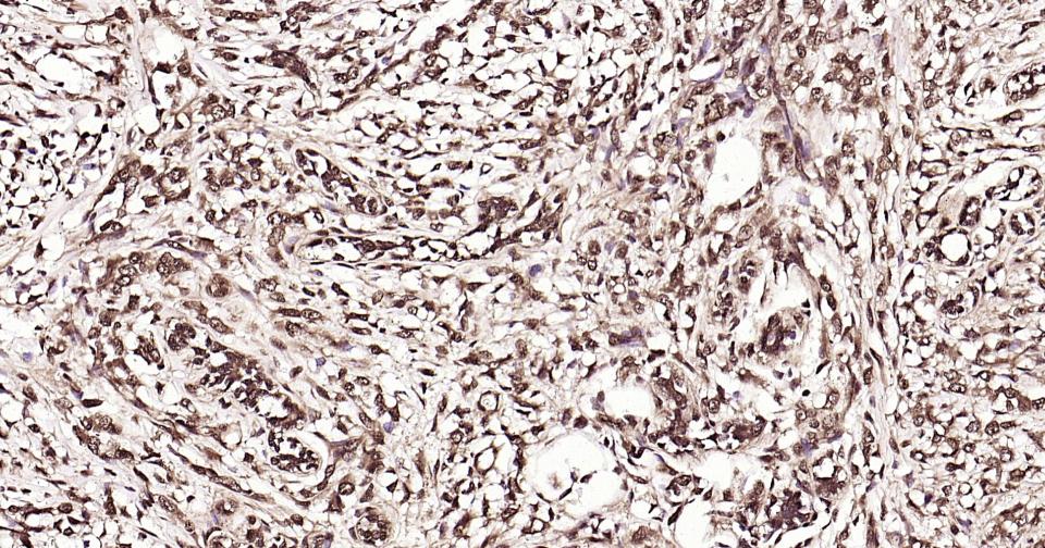 泛素蛋白重组兔单抗