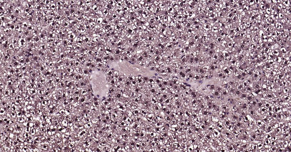 泛素蛋白（K27-linkage specific）重组兔单抗