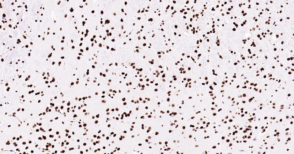 组蛋白H3(核内参)单克隆抗体-bsm-33042M