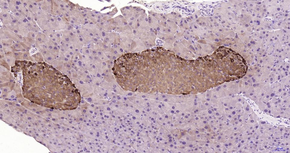 胰高血糖素重组兔单抗