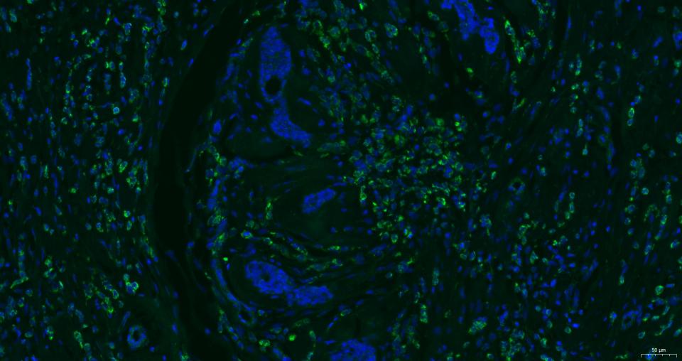 细胞表面趋化因子受体4抗体-bs-1011R