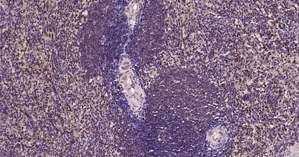 泛素蛋白（K27-linkage specific）重组兔单抗