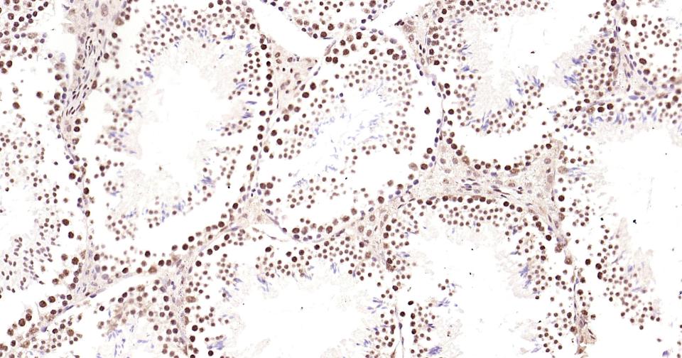 磷酸化CREB-1重组兔单抗