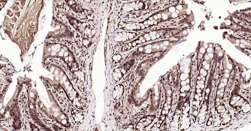 泛素蛋白（K27-linkage specific）重组兔单抗