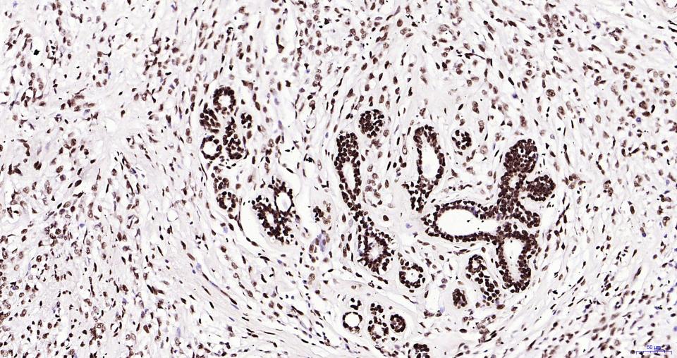 乙酰化组蛋白H3.1(Lys28)重组兔单抗