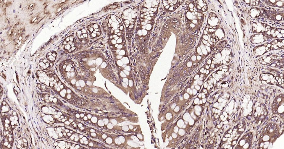 泛素蛋白（K63-linkage）重组兔单抗