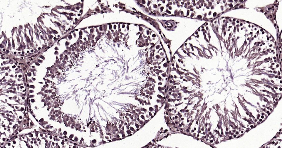 泛素蛋白（K27-linkage specific）重组兔单抗